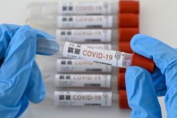 Extremadura ha realizado 192.860 pruebas diagnósticas de COVID-19 en el mes de enero