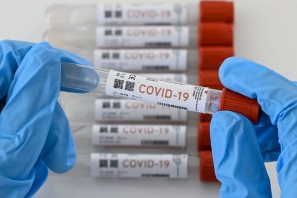 Extremadura ha realizado 192.860 pruebas diagnósticas de COVID-19 en el mes de enero